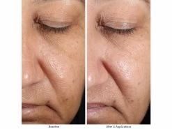 Obagi Medical Revivify Multi-Acid Facial Peel -Care Products Store ducsmfhc 202201272056175917