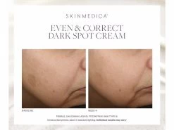 SkinMedica Even & Correct Dark Spot Cream -Care Products Store eb3wk4wt 202301161545268087
