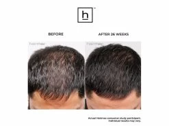 HairMax Ultima 12 LaserComb Hair Growth Device -Care Products Store emq10rab 202211092016267048