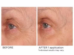 NassifMD® Age-Defying Eye Renewal Serum 13 NassifMD® Age-Defying Eye Renewal Serum -Care Products Store f05kk3fy 202202211733148416