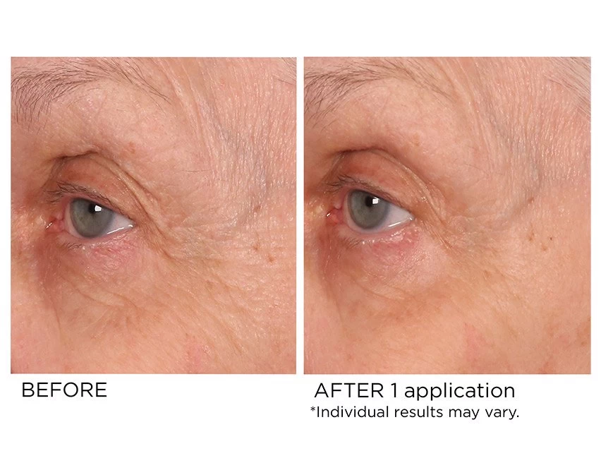 NassifMD® Age-Defying Eye Renewal Serum 7 NassifMD® Age-Defying Eye Renewal Serum - Image 5