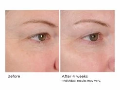 NassifMD® Peri-Orbital Complex Revitalizing Eye Cremè 9 NassifMD® Peri-Orbital Complex Revitalizing Eye Cremè -Care Products Store f1g2los0 202009231754082984