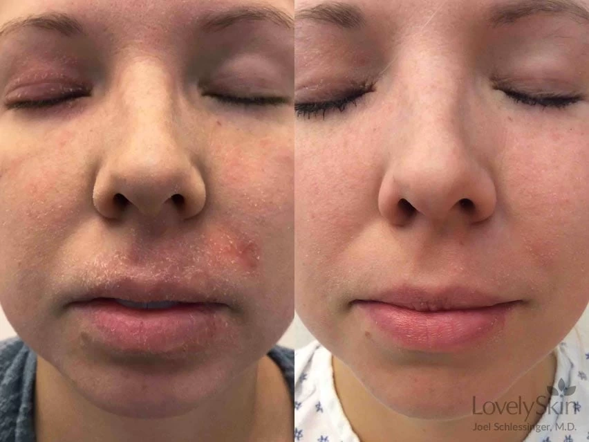 FixMySkin 1% Hydrocortisone Healing Body Balm – Fragrance-Free 4 FixMySkin 1% Hydrocortisone Healing Body Balm – Fragrance-Free - Image 2