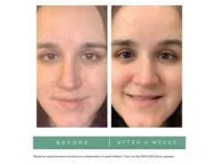 Replenix Oil-Free Balancing Moisturizer -Care Products Store fmrhtyjk 202208101804348042