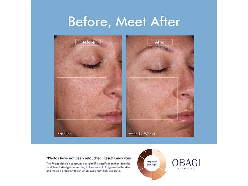OBAGI Clinical® Dark Spot Disruptor Discoloration Correcting Serum 4 OBAGI Clinical® Dark Spot Disruptor Discoloration Correcting Serum - Image 2