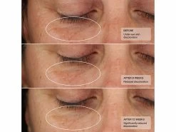 Senté Illuminé Eye Cream -Care Products Store gdirzzlo 202305051523449238