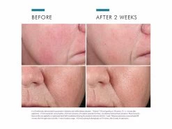 SkinCeuticals Phyto Corrective Essence Mist 14 SkinCeuticals Phyto Corrective Essence Mist -Care Products Store gkax3ji1 202207131808259544