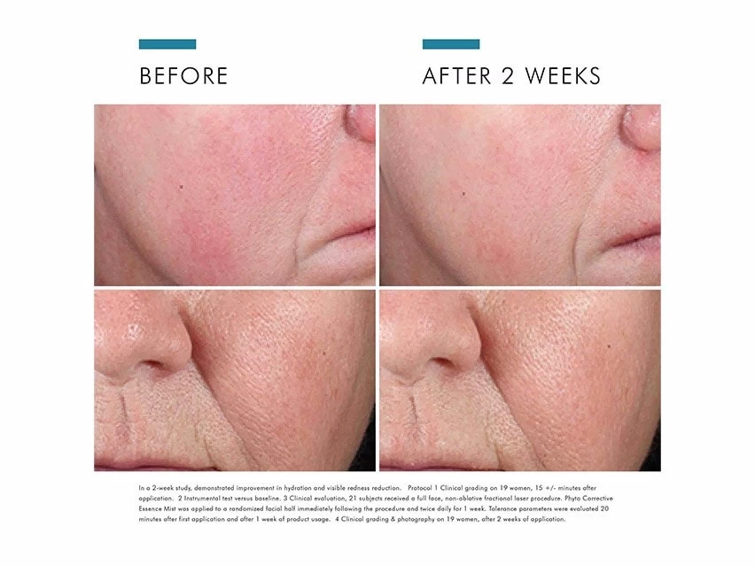 SkinCeuticals Phyto Corrective Essence Mist 5 SkinCeuticals Phyto Corrective Essence Mist - Image 3