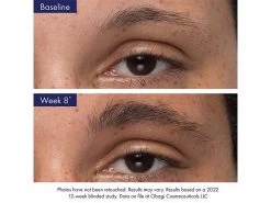 Obagi Nu-Cil™ Eyebrow Boosting Serum -Care Products Store grdvizqk 202208171950402508