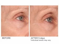 NassifMD® Age-Defying Eye Renewal Serum 12 NassifMD® Age-Defying Eye Renewal Serum -Care Products Store grgatxbp 202202211728480488