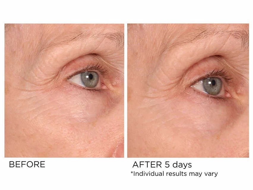 NassifMD® Age-Defying Eye Renewal Serum 6 NassifMD® Age-Defying Eye Renewal Serum - Image 4