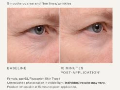 SkinMedica Instant Bright Eye Cream -Care Products Store h0jl1k4m 202002192344129567