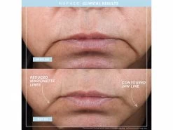 NuFACE TRINITY+ And Effective Lip & Eye Attachment -Care Products Store h0pgpasv 202206221450104894