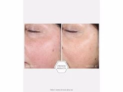 NEOSTRATA Restore PHA Renewal Pads -Care Products Store hb445g44 202210071636162025