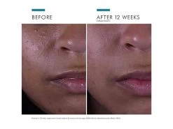 SkinCeuticals Silymarin CF Vitamin C Serum 17 SkinCeuticals Silymarin CF Vitamin C Serum -Care Products Store hcamrly4 202206071331596286