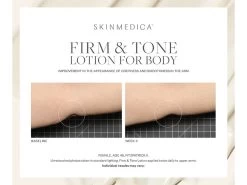 SkinMedica Firm & Tone Body Lotion -Care Products Store hchyvxpm 202208182044011536