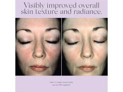 Exuviance Overnight Transformation Complex -Care Products Store hn5j4bvo 202210041311187210