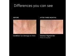 PCA SKIN Pigment Cleansing Face & Body Bar -Care Products Store hpsttb0p 202205261701259879