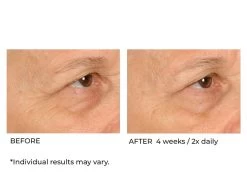 NassifMD® Hydro-Screen Hydrating Serum -Care Products Store hstipdfu 202009231640511616