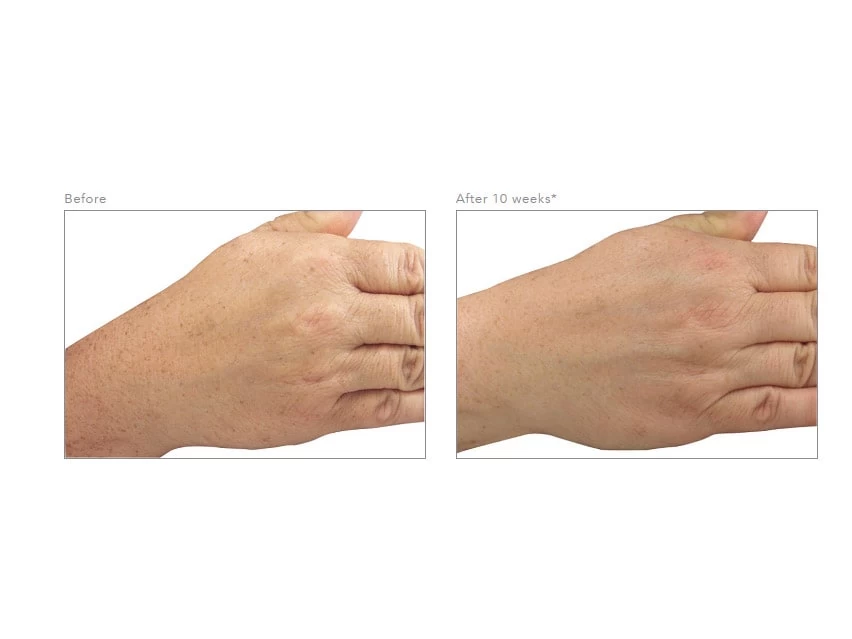 Revision Skincare Lumiquin 4 Revision Skincare Lumiquin - Image 2