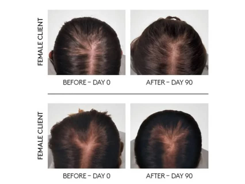 René Furterer Rene Furterer TRIPHASIC Reactional Concentrated Serum 6 René Furterer Rene Furterer TRIPHASIC Reactional Concentrated Serum - Image 4