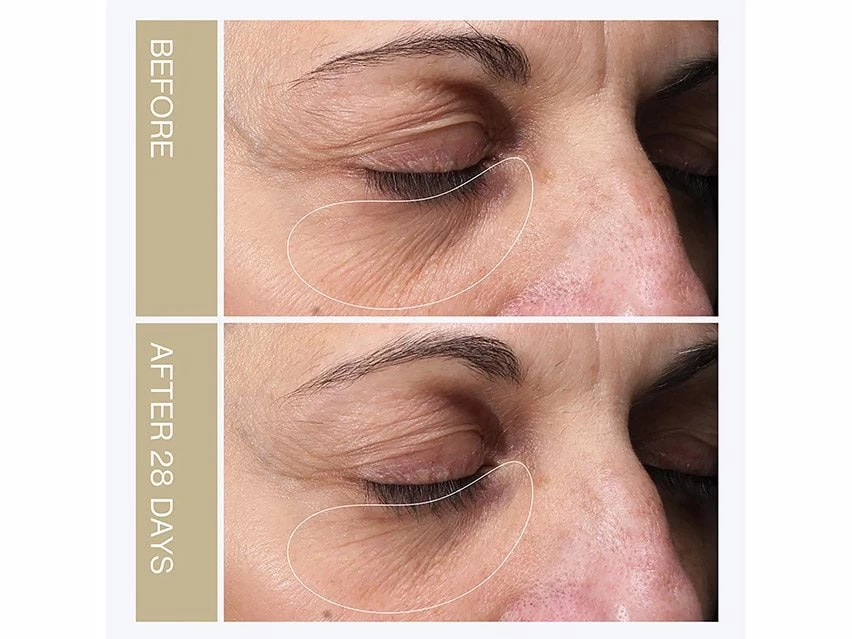 Neolastin Revitalize & Firm Eye Cream 4 Neolastin Revitalize & Firm Eye Cream - Image 2