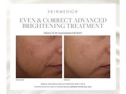 SkinMedica Even & Correct Advanced Brightening Treatment Serum -Care Products Store ioryd405 202301161537556408