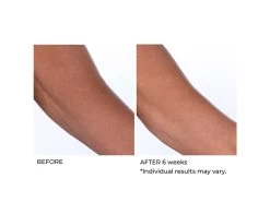 NassifMD® Crepe Inhibitor Triple Action Body Butter 10 NassifMD® Crepe Inhibitor Triple Action Body Butter -Care Products Store ipwrqkbb 202009221702274320