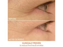 Dr. Dennis Gross Skincare DRx SpectraLite EyeCare Max Pro 13 Dr. Dennis Gross Skincare DRx SpectraLite EyeCare Max Pro -Care Products Store jfudz3ex 202301061557300764