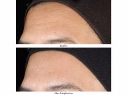 Obagi Medical Revivify Multi-Acid Facial Peel -Care Products Store jlffr0xz 202201272056447063