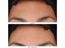 Obagi Medical Revivify Multi-Acid Facial Peel -Care Products Store jlk4nzuu 202201272055449070