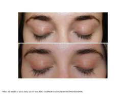 NeuLASH & NeuBROW PROFESSIONAL Eyelash & Eyebrow Enhancing Serum Duo -Care Products Store jlwplu0c 202305171822091280