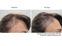 Viviscal Professional Hair Growth 9-Month Value Set -Care Products Store kurfxiz2 202301232102494753