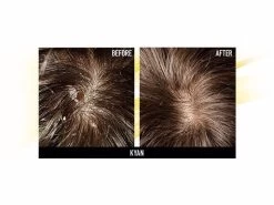 Hairsanity Anti-Dandruff Conditioner 15 Hairsanity Anti-Dandruff Conditioner -Care Products Store l4fzdxzg 202109222048528925