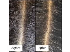 Sunday Riley Clean Rinse Clarifying Scalp Serum -Care Products Store l5opbdnp 202007061620010429