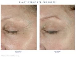 Obagi ELASTIderm Eye Cream -Care Products Store lc2u5aaw 202012231432253769