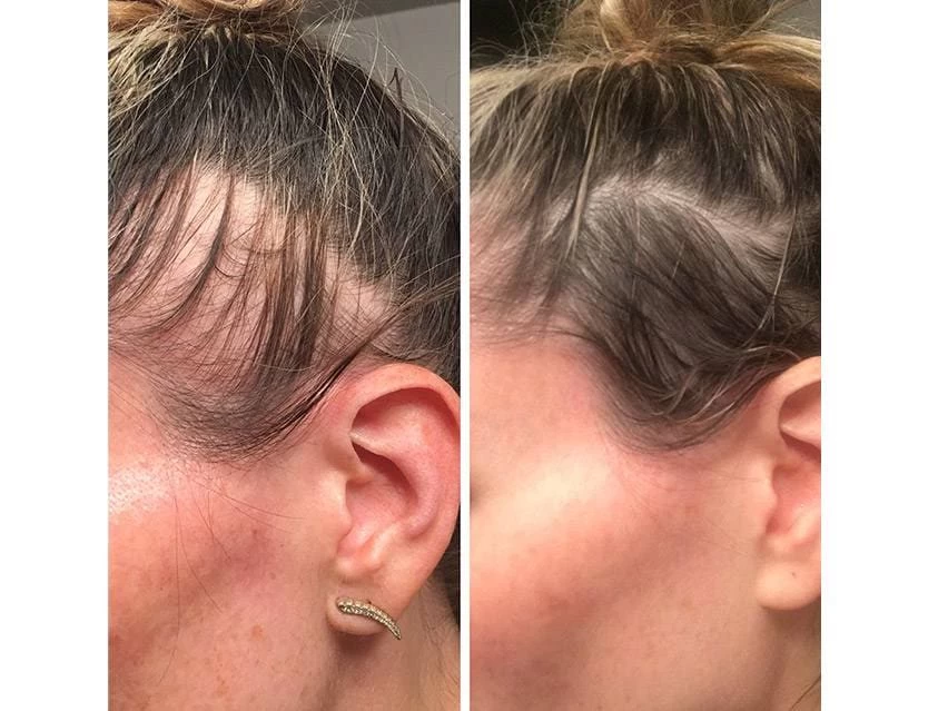 Zenagen Revolve Women's Thickening Shampoo 6 Zenagen Revolve Women's Thickening Shampoo - Image 4