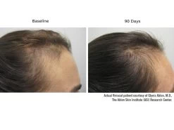 Viviscal Professional Hair Growth 9-Month Value Set -Care Products Store lgakl5xh 202301232102564446