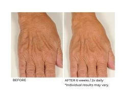 NassifMD® Hydro-Screen Hydrating Serum -Care Products Store log4pk1s 202009231642345441