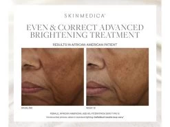 SkinMedica Even & Correct Advanced Brightening Treatment Serum -Care Products Store lx44nln0 202301161538143895