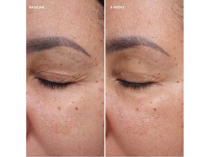 Colorescience Total Eye Firm & Repair Cream 5 Colorescience Total Eye Firm & Repair Cream - Image 3