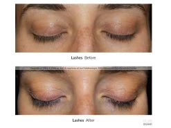 NeuLASH/neuBROW PROFESSIONAL™ By Skin Research Laboratories® Introductory Kit 15 NeuLASH/neuBROW PROFESSIONAL™ By Skin Research Laboratories® Introductory Kit -Care Products Store myx5qqnr 202004082231591792