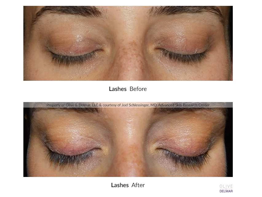 NeuLASH/neuBROW PROFESSIONAL™ By Skin Research Laboratories® Introductory Kit 8 NeuLASH/neuBROW PROFESSIONAL™ By Skin Research Laboratories® Introductory Kit - Image 6