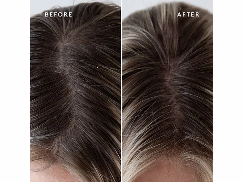 VIRTUE Topical Scalp Supplement Overnight Serum 5 VIRTUE Topical Scalp Supplement Overnight Serum - Image 3