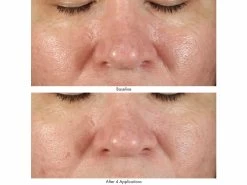 Obagi Medical Revivify Multi-Acid Facial Peel -Care Products Store oefwoy3u 202201272057396890