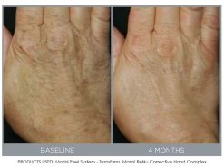 Jan Marini ReNu Corrective Hand Complex -Care Products Store oigz5hwm 201809111634169450