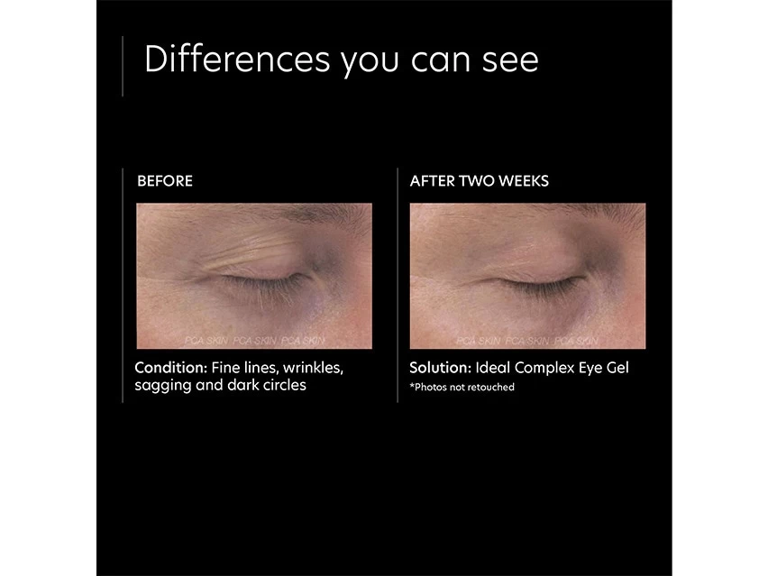 PCA SKIN Ideal Complex Revitalizing Eye Gel 9 PCA SKIN Ideal Complex Revitalizing Eye Gel - Image 7