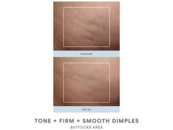 NuFACE NuBODY Skin Toning Device -Care Products Store opm5apof 202201101536136674