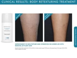 SkinCeuticals Body Retexturing + Exfoliating Treatment 5 SkinCeuticals Body Retexturing + Exfoliating Treatment -Care Products Store ouz3tmxb 202011061624335464