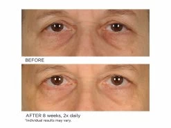 NassifMD® Anti-Aging Under Eye Smoother 8 NassifMD® Anti-Aging Under Eye Smoother -Care Products Store ov1yyog2 202009231839498383